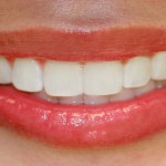 teeth