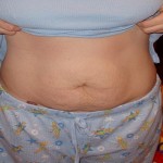 Women Gain Weight Post Pregnancy1