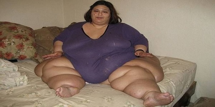 दुनिया की सबसे मोटी महिला हुई स्लिम, एक हादसे ने बदली ज़िन्दगी