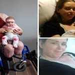Doctor Amputated Woman’s Both’s Legs