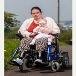 Doctor Amputated Woman’s Both’s Legs2