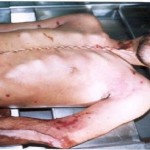postmortem2