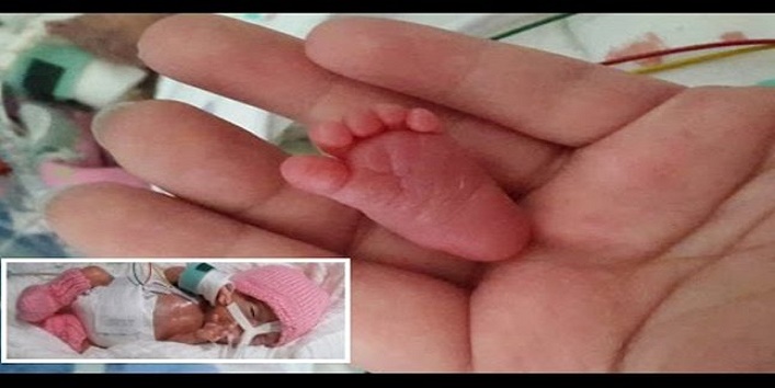 पैदा हुई दुनिया की सबसे छोटी बच्ची, देखें तस्वीरें