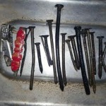 22-metal-glass-objects-from-womans-stomach