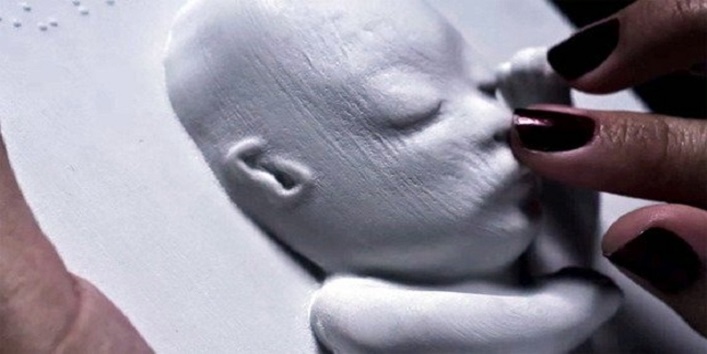 3d-printing-lets-blind-mothersblind-mother-ultrasounds-unborn-babies3d-printed-baby-ultrasound3d-printed-baby-scan1
