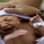 Sueli Maria holds her daughter Milena, who has microcephaly, at a hospital in Recife