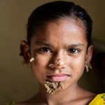 shana-ill-tree-dhaka