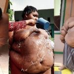 10 years old kid weighs 200 kg eating noodles and having coke cover pic