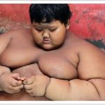 10 years old kid weighs 200 kg eating noodles and having coke1
