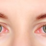 Red-Eyes