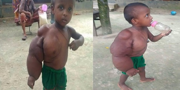 this 2 year old baby girl has hands weighing 3 kilos cover