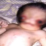 this woman delivers a baby without ears content
