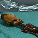 skeleton 1