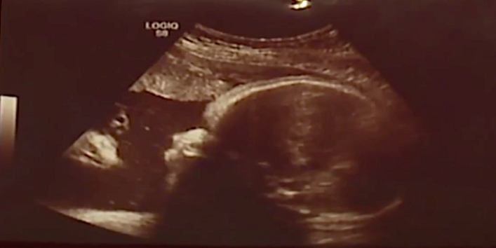 jesus christ shown in the ultrasound of this woman and picture goes viral cover
